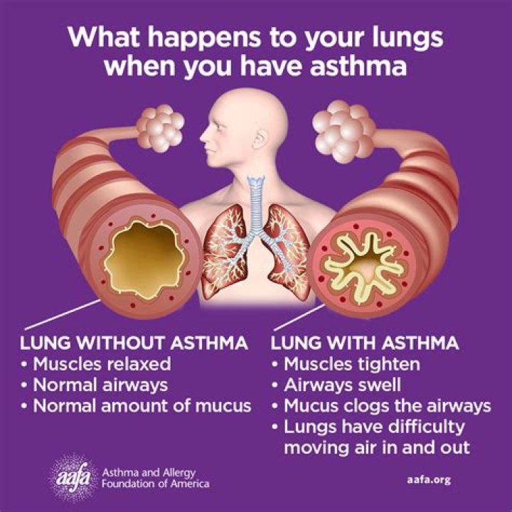 Does heat make asthma worse?