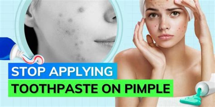Does honey work to get rid of pimples?