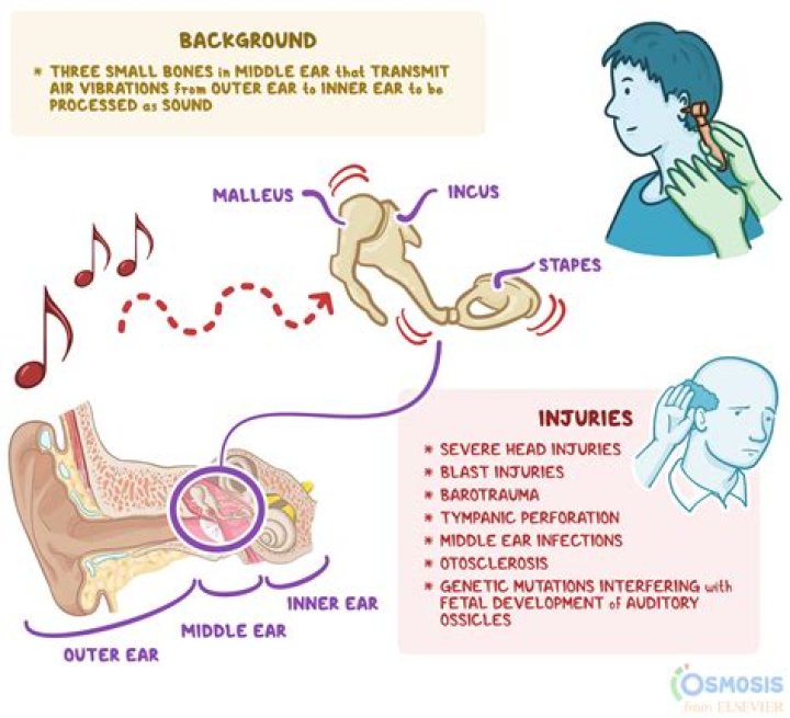 Does listening to music Increase ear wax?