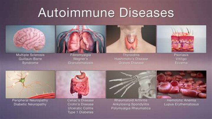 Does magnesium help with autoimmune diseases?