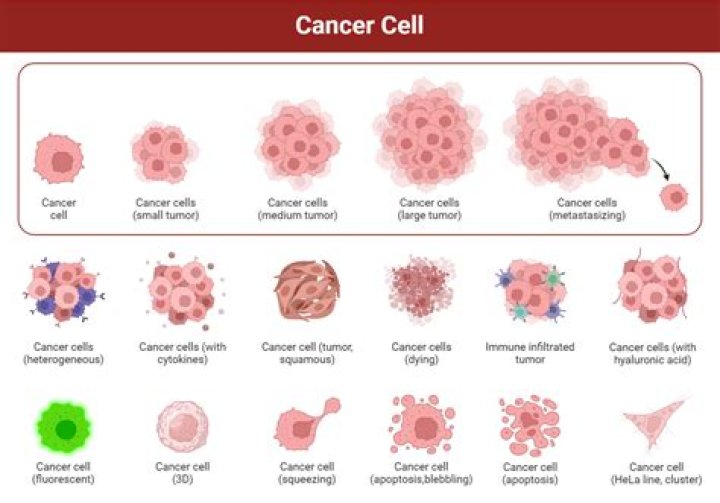 Does melanoma lead to other cancers?