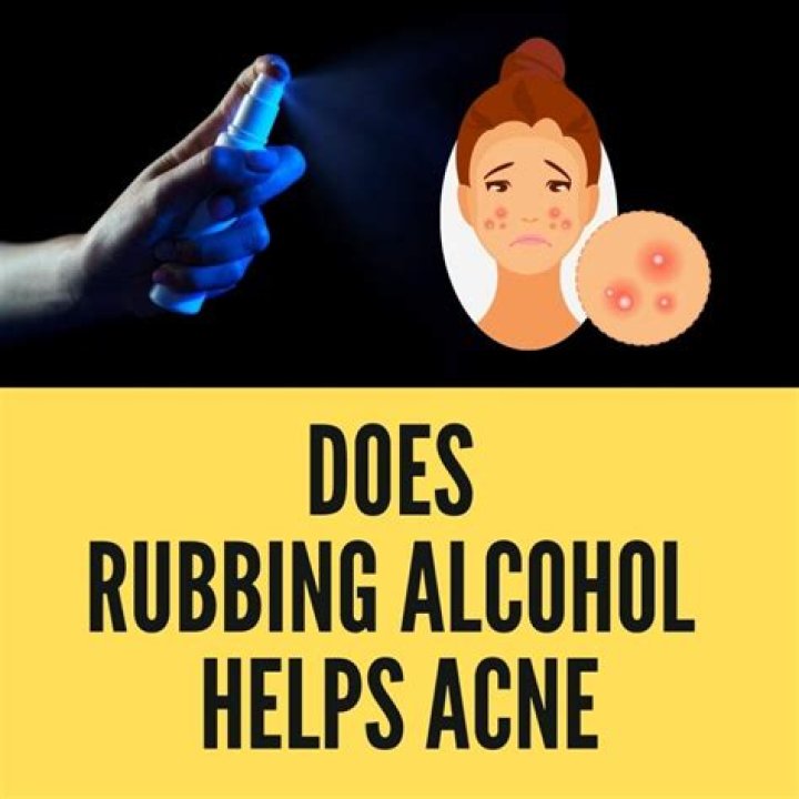 Does rubbing alcohol help with scabies?