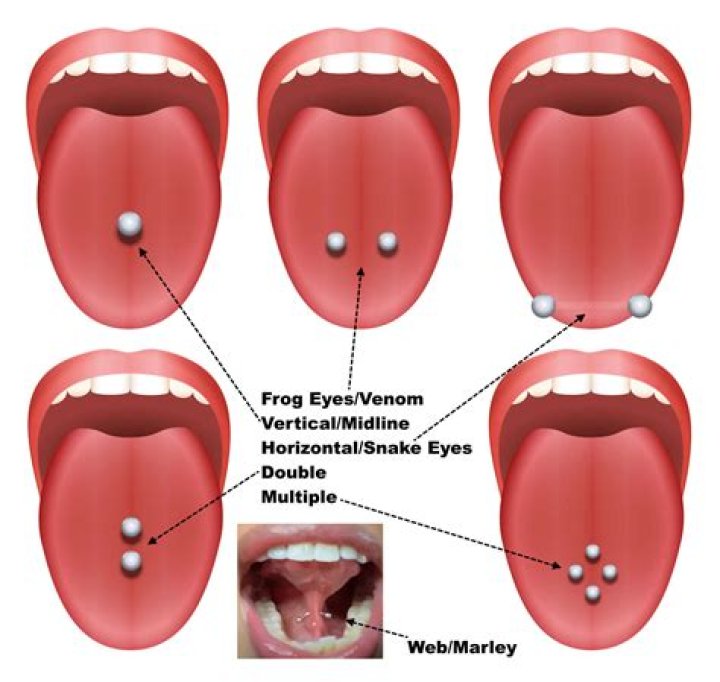 Does salt water heal tongue piercing?