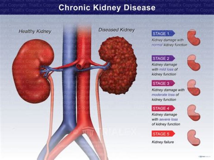 Does sepsis cause permanent kidney damage?