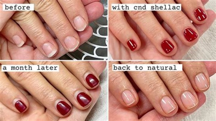 Does shellac ruin your nails?