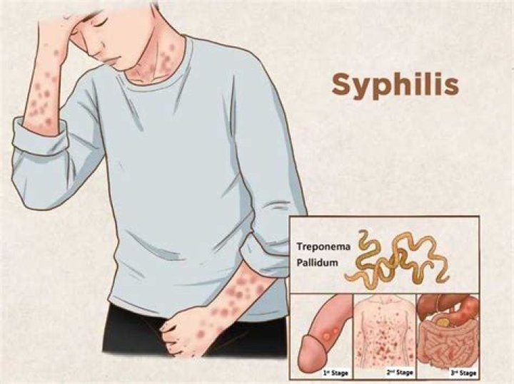 Does syphilis hurt?