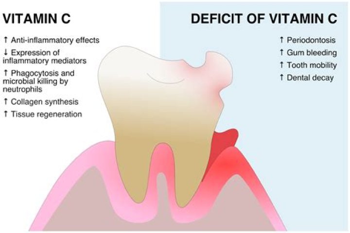 Does vitamin D deficiency affect gums?