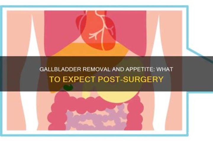 Does your appetite change after gallbladder removal?