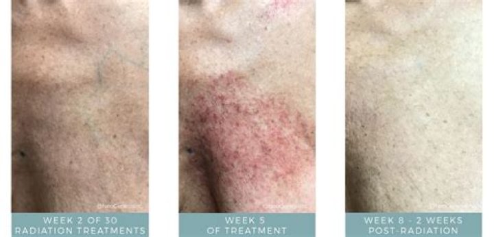 Does your skin change at 25?