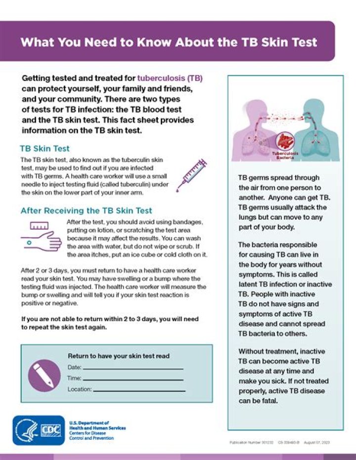 How a TB test should look?