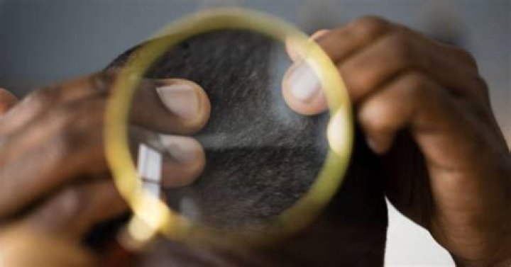How can African Americans get clear skin?
