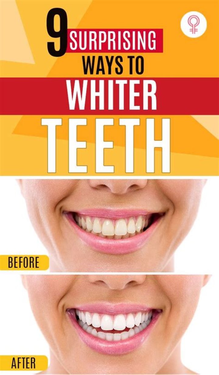 How can get white teeth?