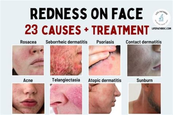 How can I tone my face at home?