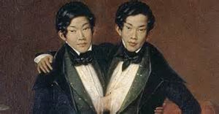 How did the original Siamese twins died?