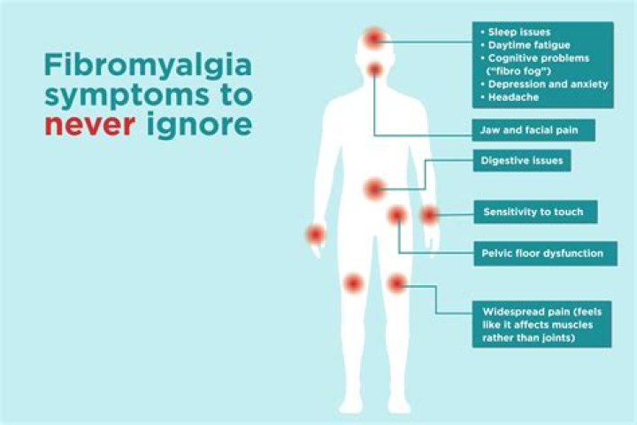 How do doctors know if you have fibromyalgia?