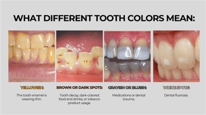 How do I keep coffee from turning my teeth yellow?