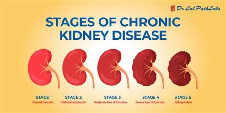 How do I know if my kidney is not working properly?