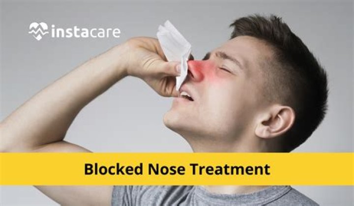 How do you cure a blocked nose?