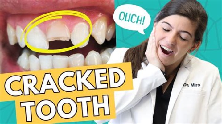 How do you fix a rotten tooth?