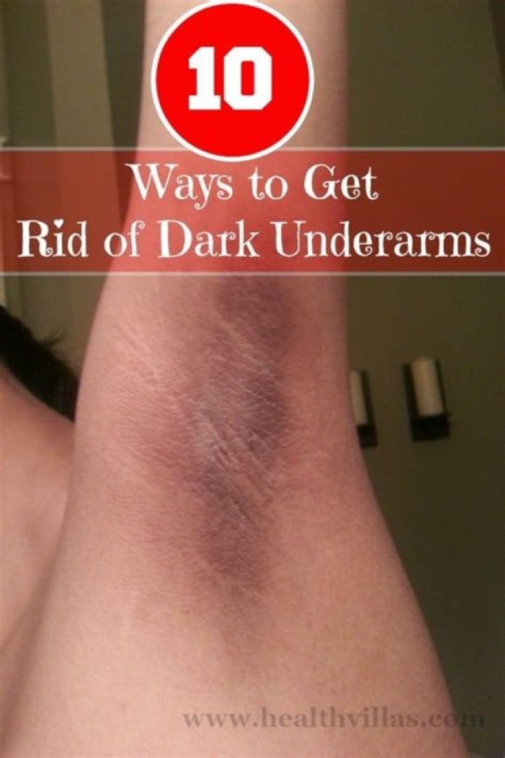 How do you get rid of dark underarms permanently?