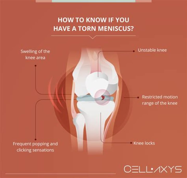 How do you know if you have a torn meniscus in your knee?