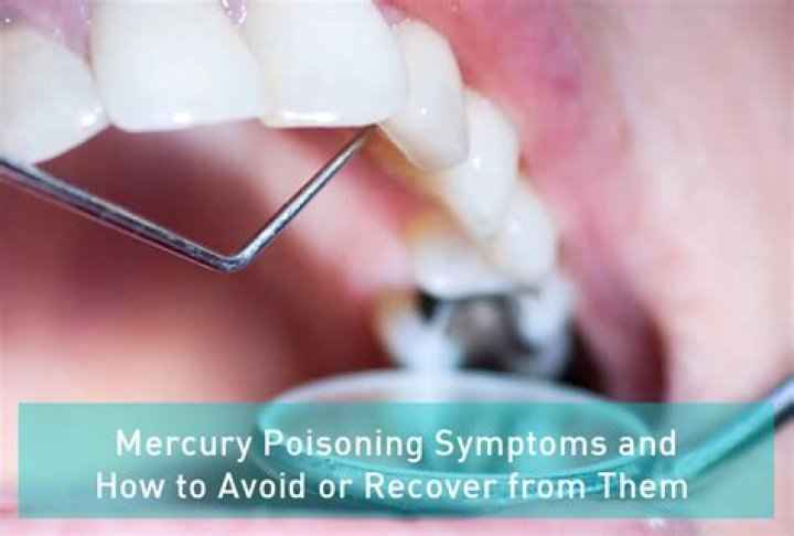 How do you know if you have mercury poisoning from fillings?