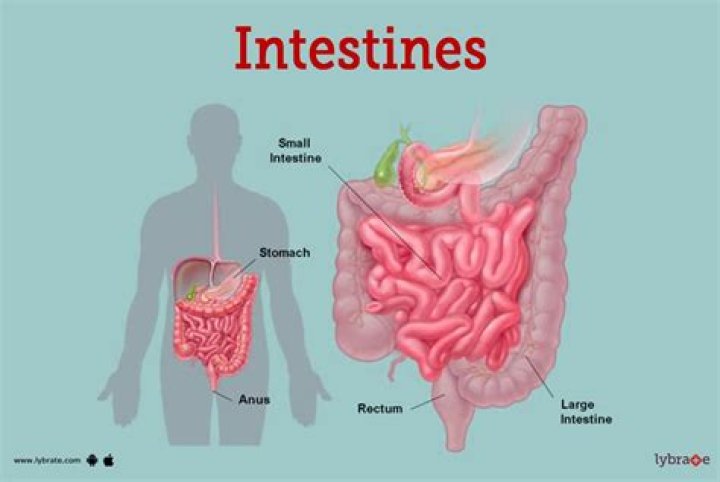 How do you know if your intestines are twisted?