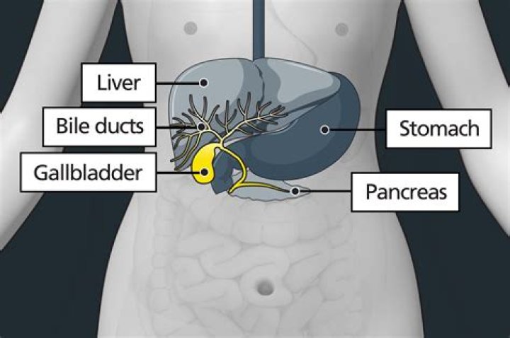How do you know when your gallbladder needs to be taken out?