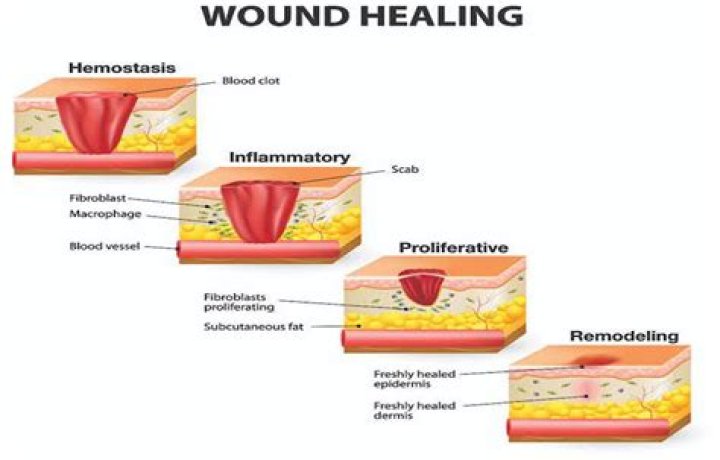 How do you tell if an abscess is healing?