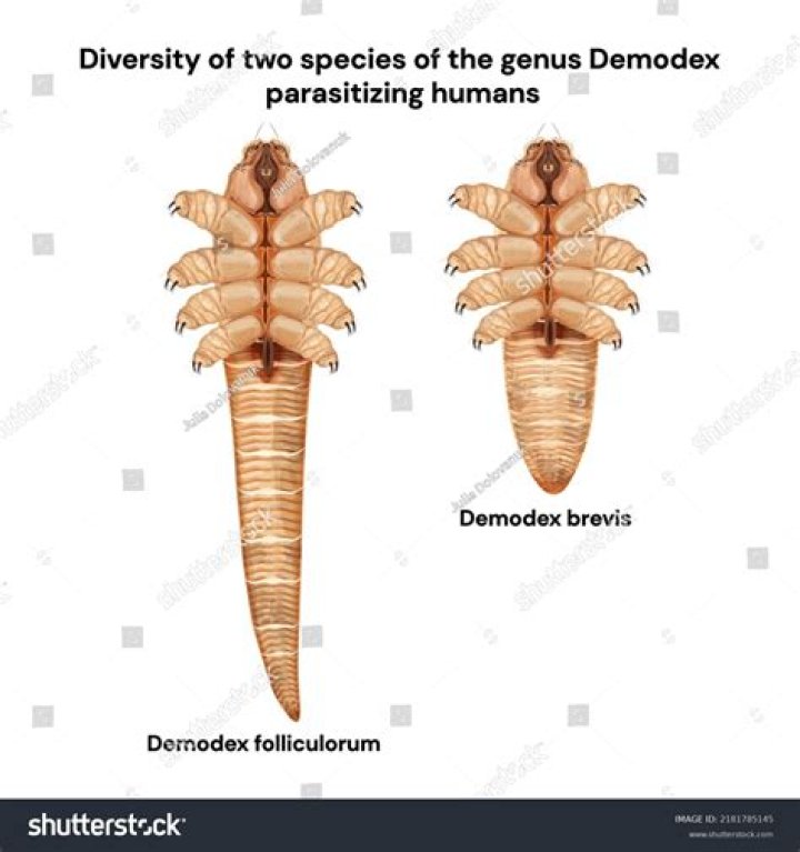 How do you tell if you have Demodex mites?