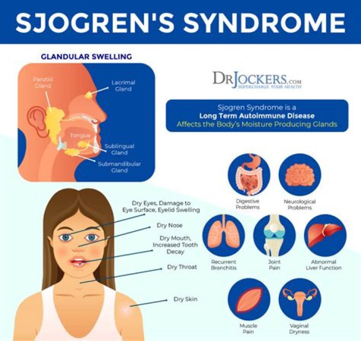 How does Sjogren's affect the throat?