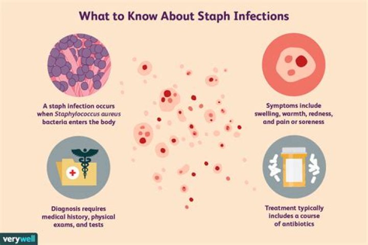How does staph infection start?