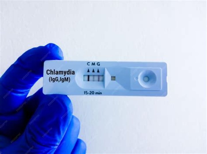 How likely is a false positive chlamydia test?
