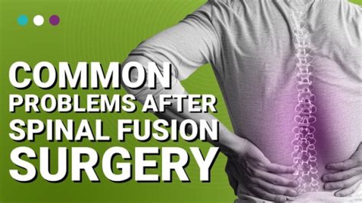 How long are you in the hospital after a spinal fusion?