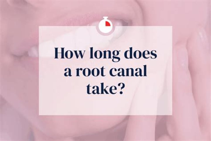 How long do root canals take?