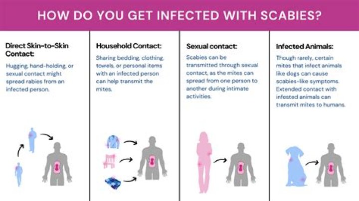 How long do scabies live on furniture?