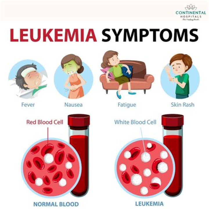 How long do you have leukemia before symptoms?