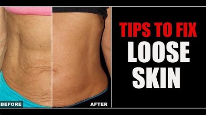 How long does it take for loose skin to tighten?