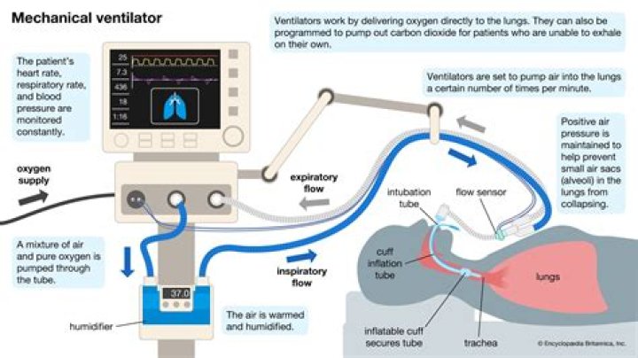 How long is too long on a ventilator?
