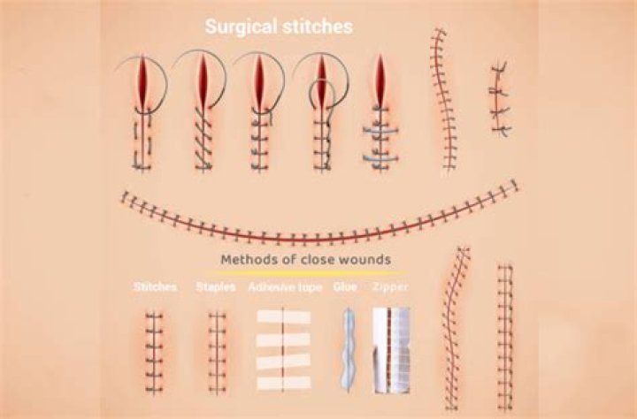 How long will an incision hurt?