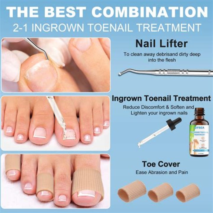 How much does it cost to take out an ingrown toenail?