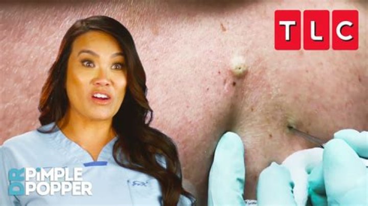 How much does it cost to visit Dr. Pimple Popper?