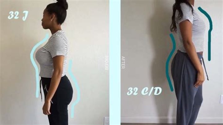 How much is a breast reduction?