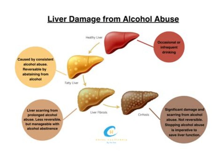 How much would you have to drink to damage your liver?