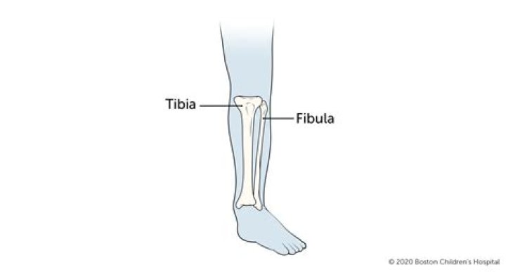 How painful is a broken tibia and fibula?