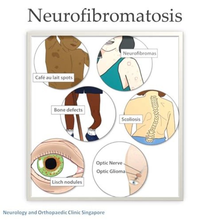How quickly do neurofibromas grow?