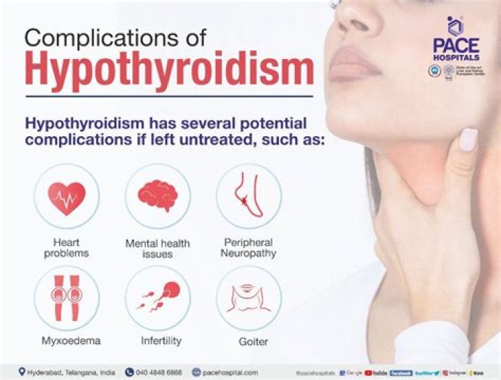 How serious is hypothyroidism?