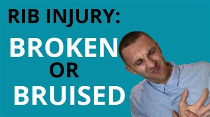 Is a bruised rib bad?