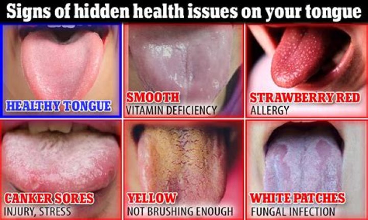 Is a red tongue healthy?