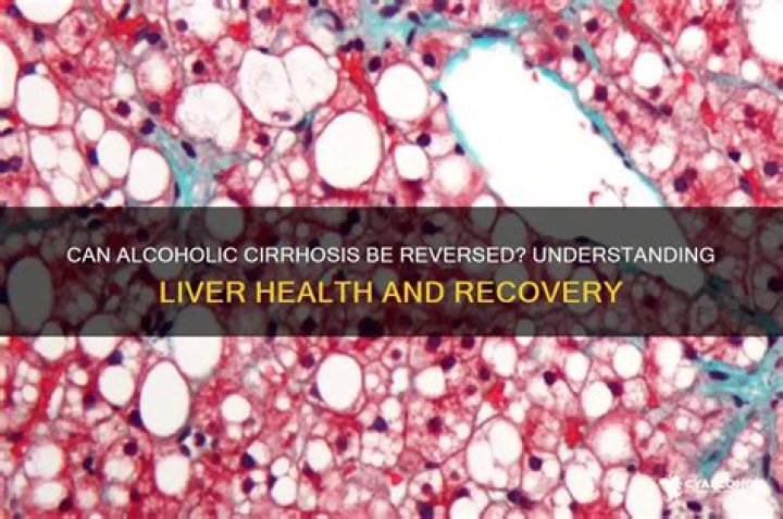 Is alcoholic cirrhosis reversible?